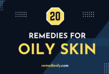 oily skin remedies