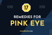pink eye remedies