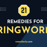 Ringworm Home Remedies