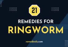 Ringworm Home Remedies
