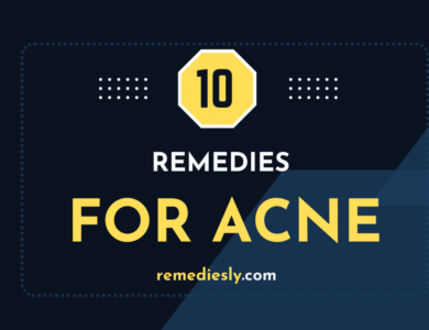 10 Home Remedies for Acne
