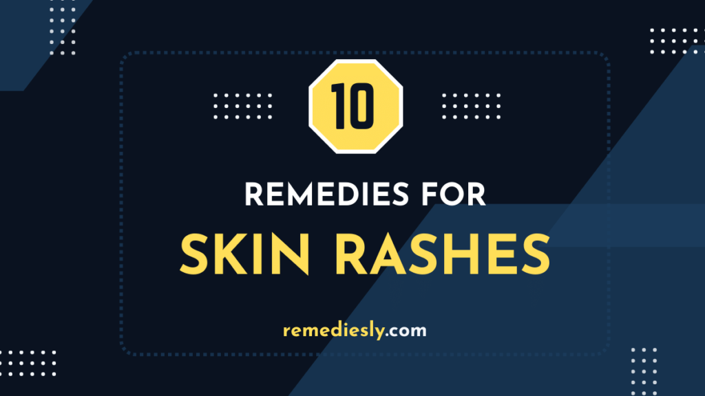 10 Powerful Heal Rashes Remedies