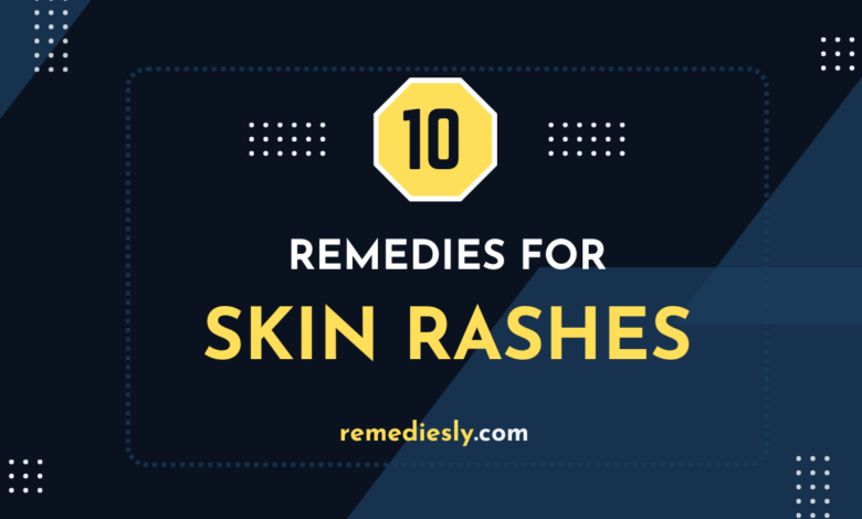 10 Powerful Heal Rashes Remedies