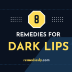 8 Effective Dark Lips Remedies