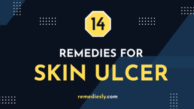 natural remedies for skin ulcer