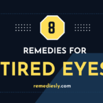 Tired Eyes - Home remedies for Tired Eyes