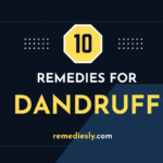 Top 10 Effective Dandruff Remedies