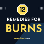 remedies for burns
